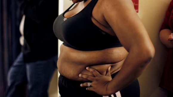 Obesity a killing of Black Women!