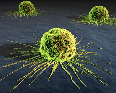 15 Cancer Symptoms Men Ignore